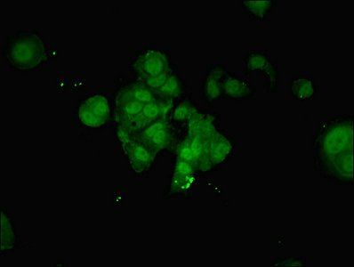 NUP210 Antibody
