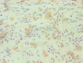 RORC Antibody