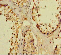 NR1I3 Antibody