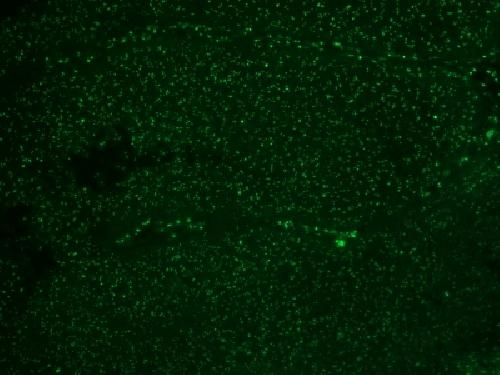 Human Nucleolar Antigen (Marker For Human Cells) Antibody