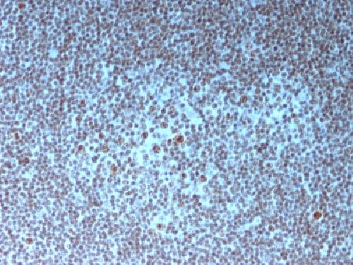 Human Nucleolar Antigen (Marker For Human Cells) Antibody