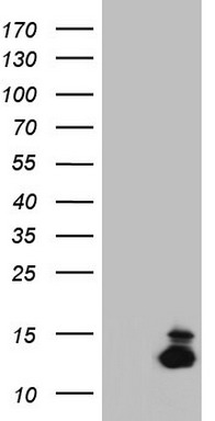 Nucleophosmin Antibody