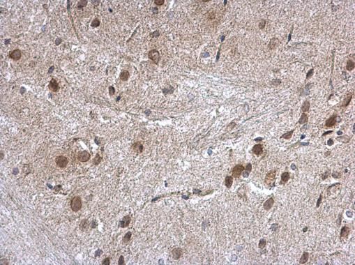 Nucleoporin p62 Rabbit Polyclonal Antibody