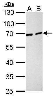 Nucleoporin p62 Rabbit Polyclonal Antibody