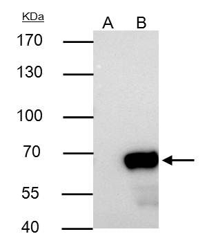 Nucleoporin p62 Rabbit Polyclonal Antibody