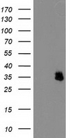 NUDT6 Antibody