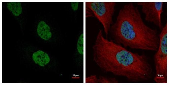 nuclear mitotic apparatus protein 1 Antibody
