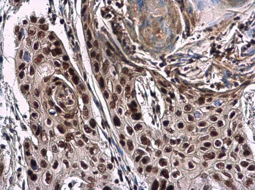 nuclear mitotic apparatus protein 1 Antibody