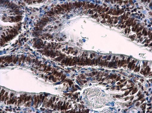 nuclear mitotic apparatus protein 1 Antibody