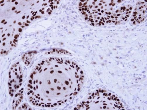 nuclear mitotic apparatus protein 1 Antibody