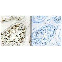 NUMA1 Antibody