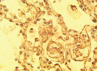 Rabbit Human NUMB Antibody