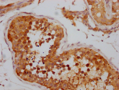 NUP98 Antibody