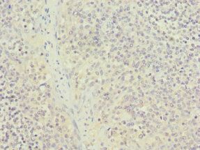 NUTF2 Antibody