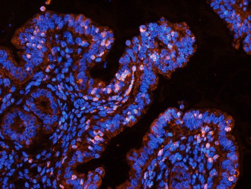 NXT2 Rabbit Polyclonal Antibody