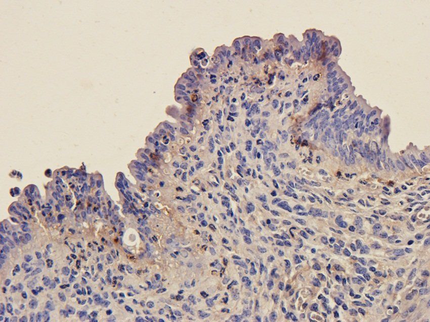 NXT2 Rabbit Polyclonal Antibody