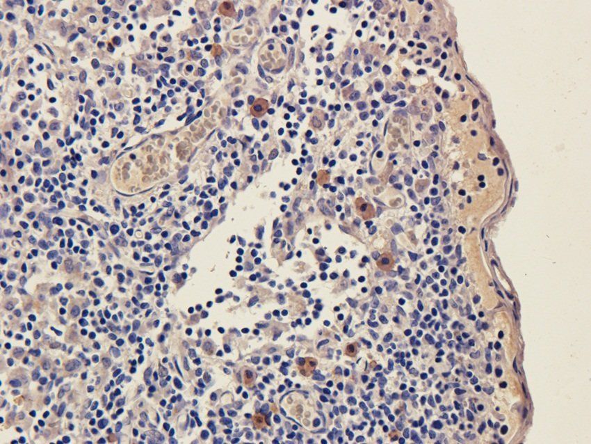 NXT2 Rabbit Polyclonal Antibody