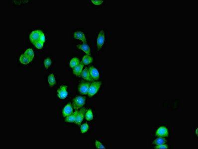 SEPSECS Antibody