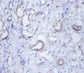 SEPSECS Antibody