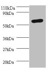 SEPSECS Antibody