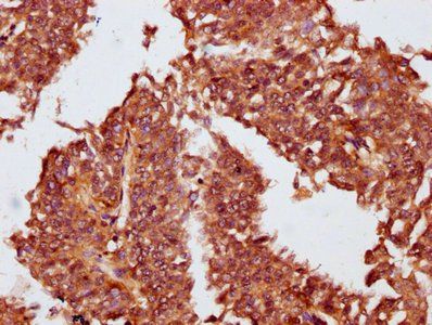 OBSCN Antibody