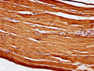 OBSCN Antibody