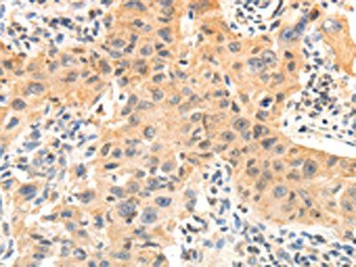 OCLN Antibody
