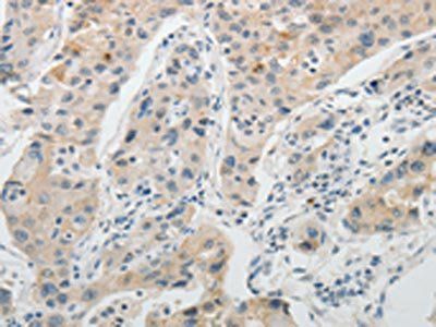 OCLN Antibody