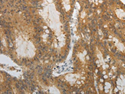 OCLN Antibody
