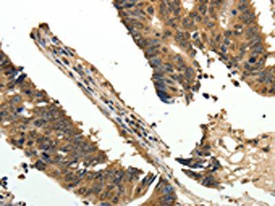 ODC1 Antibody