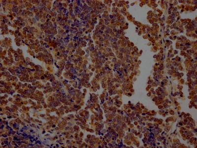 OGT Antibody