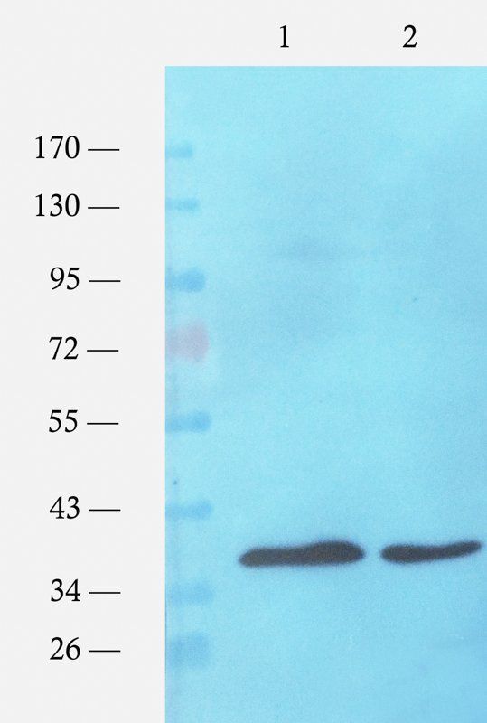 ompC Rabbit Polyclonal Antibody