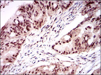 ONECUT3 Antibody