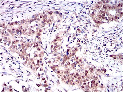 ONECUT3 Antibody
