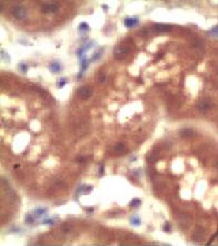 Osteoprotegerin Rabbit Polyclonal Antibody