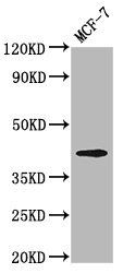 OPN1MW Antibody