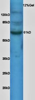 SNX1 Rabbit Polyclonal Antibody