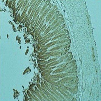 RAB27A, member RAS oncogene family Antibody