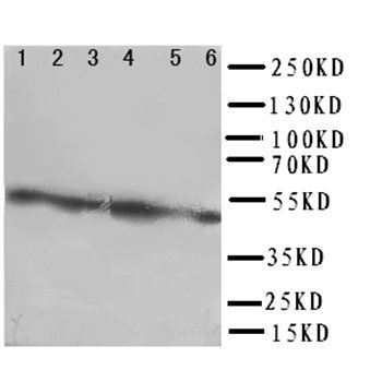 Coxsackie Adenovirus Receptor/CXADR Rabbit Polyclonal Antibody
