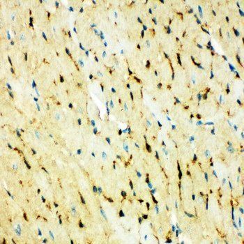 Fatty Acid Binding Protein 5/FABP5 Rabbit Polyclonal Antibody