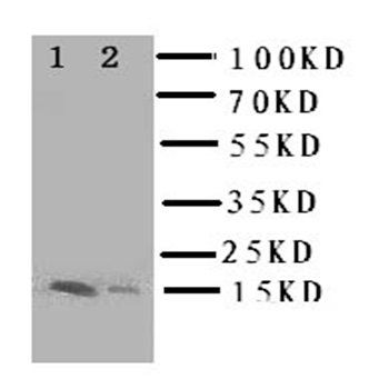 Fatty Acid Binding Protein 5/FABP5 Rabbit Polyclonal Antibody