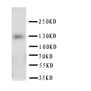 PTCH2 Rabbit Polyclonal Antibody