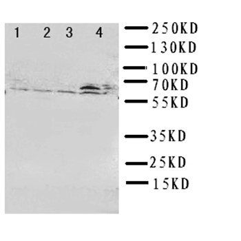 RIP2/RIPK2 Rabbit Polyclonal Antibody