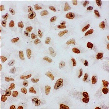 splicing factor 1/SF1 Rabbit Polyclonal Antibody
