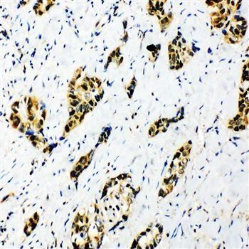 splicing factor 1/SF1 Rabbit Polyclonal Antibody