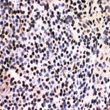 splicing factor 1/SF1 Rabbit Polyclonal Antibody