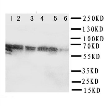 splicing factor 1/SF1 Rabbit Polyclonal Antibody