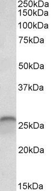 calbindin D28 Antibody