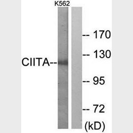 Akt (Phospho-Ser473) Antibody