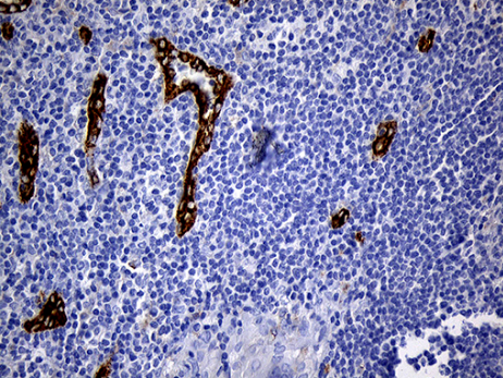 TSPAN7 Antibody